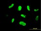 MAK Antibody (monoclonal) (M01)